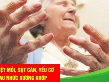 Thông tin doanh nghiệp - Mệt mỏi, sụt cân ở người đau nhức xương khớp - “Thủ phạm” đằng sau khiến bạn “hốt hoảng” 