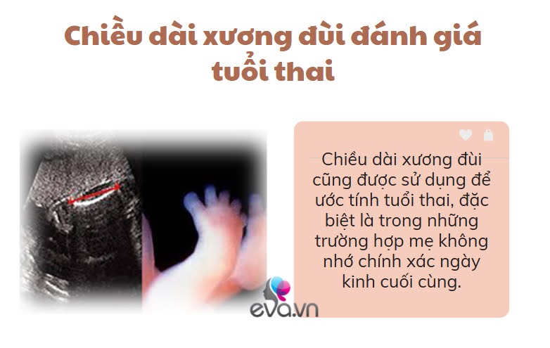 Chân con có dài như siêu mẫu hay không, mẹ cần biết rõ 4 yếu tố ảnh hưởng đến chiều dài xương đùi của thai nhi - 3