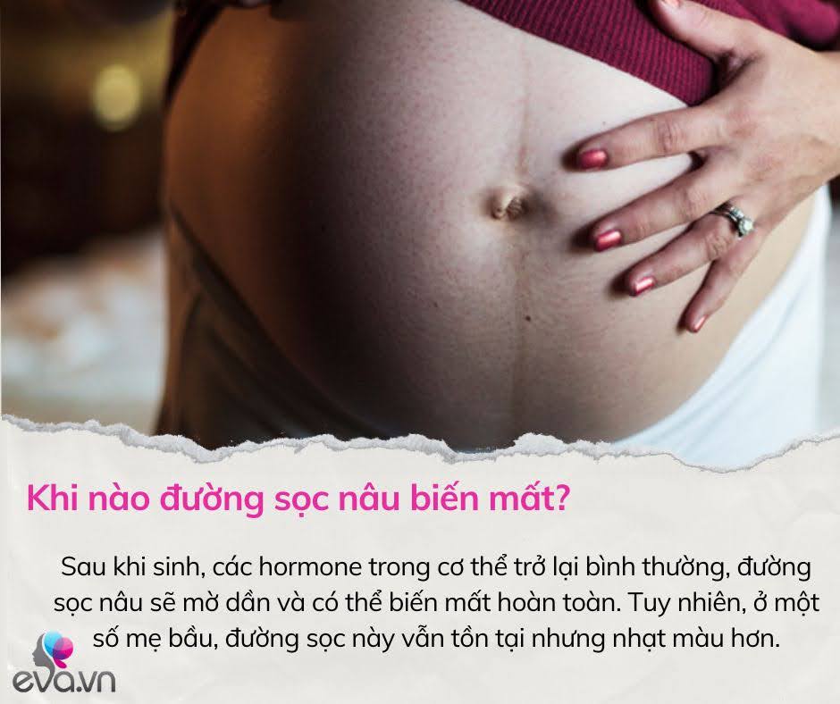 Mang thai bé đầu lòng, mẹ bầu hốt hoảng khi thấy một vệt nâu chạy dài trên bụng, các bác sĩ nói gì? - 8