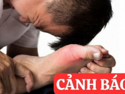 Thông tin doanh nghiệp - 6 thói quen tàn phá xương khớp tưởng vô hại nhưng cực nguy hiểm