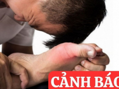Thông tin doanh nghiệp - 6 thói quen tàn phá xương khớp cực nguy hiểm cần dừng lại ngay lập tức!