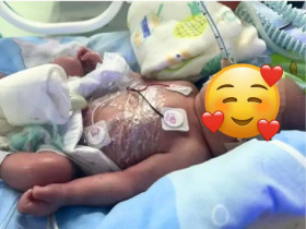 70 ngày cứu sản phụ suy cổ tử cung, dọa sinh non, mẹ rơi nước mắt khi theo dõi sự phát triển của thiên thần nhỏ mỗi ngày