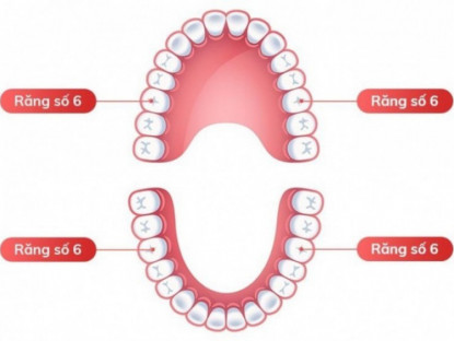 Thông tin doanh nghiệp - Hậu quả của mất răng số 6 sớm và cách khắc phục hiệu quả