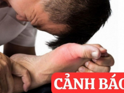 Thông tin doanh nghiệp - 6 thói quen cực nguy hiểm tàn phá xương khớp cần dừng lại ngay lập tức!