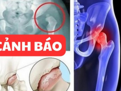 Thông tin doanh nghiệp - Đau nhức háng tận trong xương cần phải làm ngay điều này!