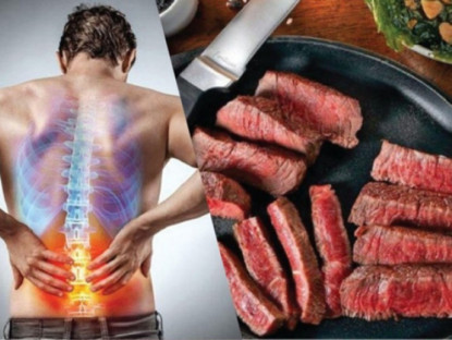 Thông tin doanh nghiệp - 5 thực phẩm hủy hoại xương khớp mà nhiều người Việt vẫn mê mẩn!