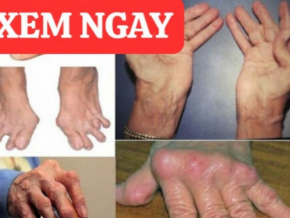 Thông tin doanh nghiệp - Giật mình thói quen cực nguy hiểm tàn phá xương khớp không phải ai cũng biết!