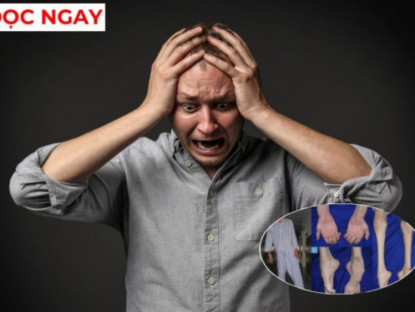 Thông tin doanh nghiệp - Đừng bỏ qua: 3 biểu hiện lạ ở người đau nhức xương khớp cảnh báo cơ thể đang suy kiệt
