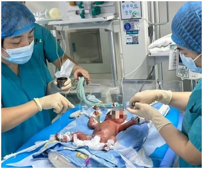 Hành trình 70 ngày giành giật sự sống của mẹ bầu có cổ tử cung bất thường - 1