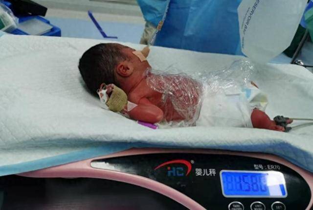 Hành trình 70 ngày giành giật sự sống của mẹ bầu có cổ tử cung bất thường - 2