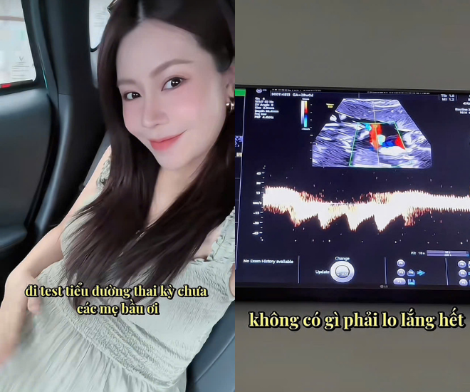 Cặp chị em dâu nổi tiếng màn ảnh Việt cùng thông báo mang thai và chuẩn bị sinh con trong năm 2025, được chồng cưng như trứng - 2