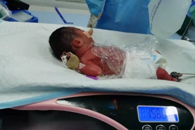 70 ngày cứu sản phụ suy cổ tử cung, dọa sinh non, mẹ rơi nước mắt khi theo dõi sự phát triển của thiên thần nhỏ mỗi ngày - 2