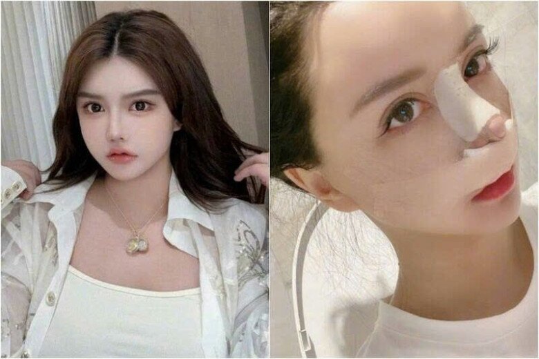 Hot girl 4 đời chồng đau lòng thông báo không giữ được cặp song thai, tiết lộ lý do liên quan đến ca nâng mũi 3 tháng trước - 5