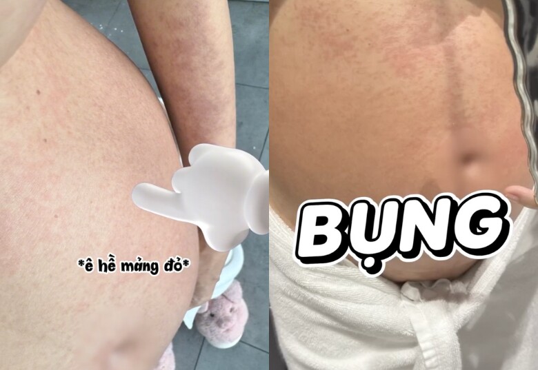 Ngô Thanh Vân gặp khủng hoảng vì mắc bệnh trong thai kỳ, lo sốt vó khi suốt 2 tuần em bé không lên ký - 3