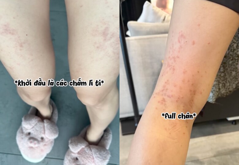 Ngô Thanh Vân gặp khủng hoảng vì mắc bệnh trong thai kỳ, lo sốt vó khi suốt 2 tuần em bé không lên ký - 4