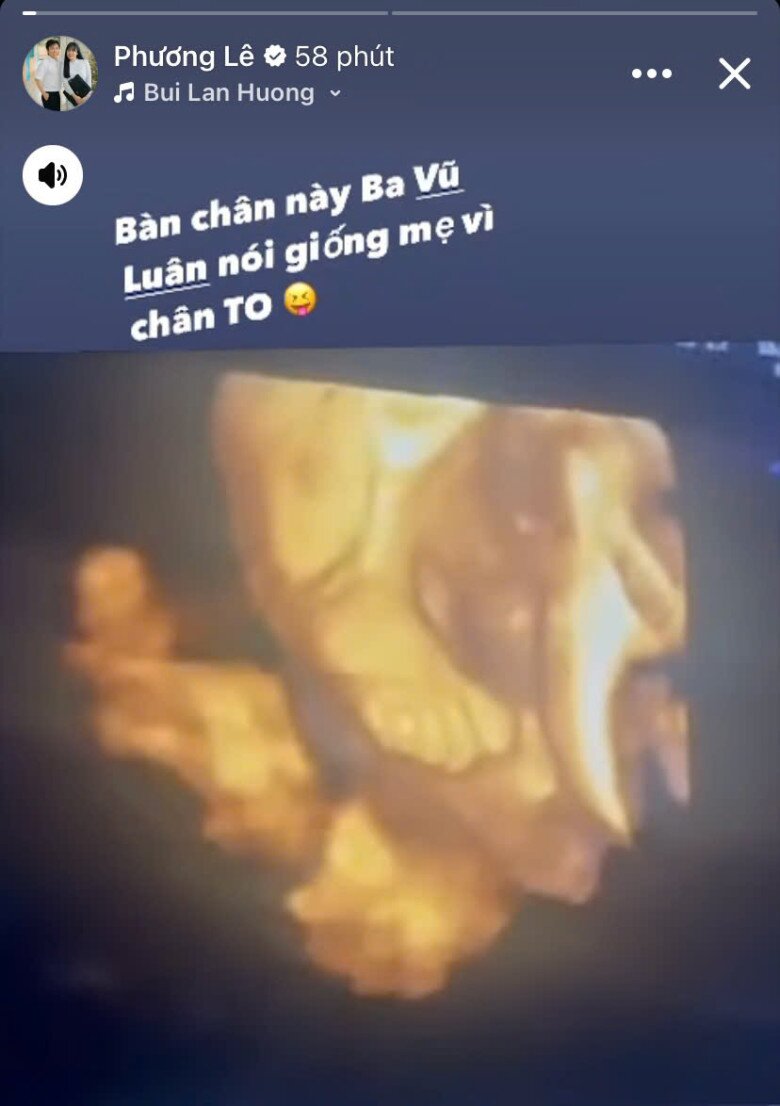 Hoa hậu Phương Lê khoe ảnh siêu âm con gái thứ 4, NSƯT Vũ Luân trầm trồ vì ái nữ chưa chào đời đã sở hữu đặc điểm giống hệt mẹ - 3