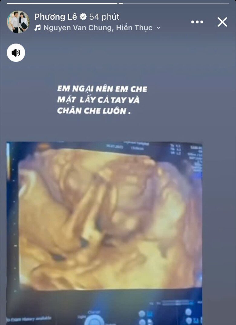 Hoa hậu Phương Lê khoe ảnh siêu âm con gái thứ 4, NSƯT Vũ Luân trầm trồ vì ái nữ chưa chào đời đã sở hữu đặc điểm giống hệt mẹ - 2