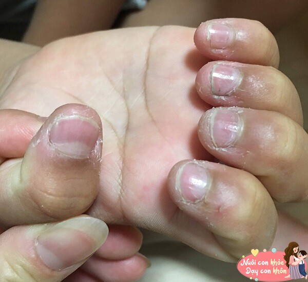 Trẻ thích cắn móng tay có hai kết cục khi lớn lên, cả hai đều là kết quả bố mẹ không muốn thấy - 4