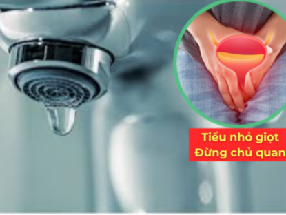 Thông tin doanh nghiệp - Đi tiểu liên tục nhưng nhỏ giọt như “cà phê phin”: Coi chừng tuyến tiền liệt đang “xuống cấp”