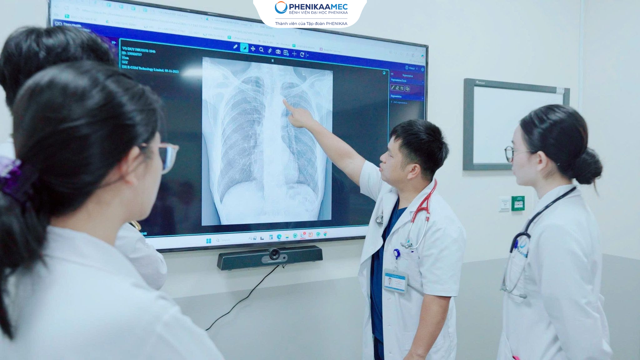 Phát hiện sớm nguy cơ đột quỵ: Chuyên gia khuyến nghị 5 nhóm người cần đặc biệt lưu ý - 2
