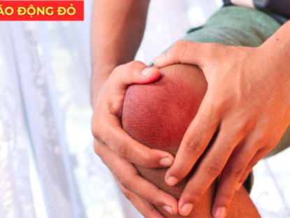 Thông tin doanh nghiệp - 5 dấu hiệu “báo động đỏ” cảnh báo xương khớp đang xuống cấp nghiêm trọng