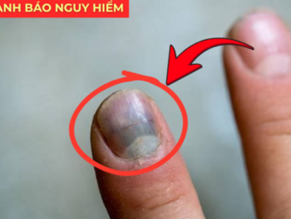 Thông tin doanh nghiệp - 5 dấu hiệu báo động phổi đang "xuống cấp": Nhiều người hối hận vì biết quá muộn!