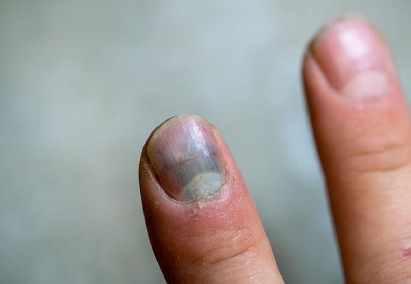 5 dấu hiệu báo động phổi đang "xuống cấp": Nhiều người hối hận vì biết quá muộn! - 3