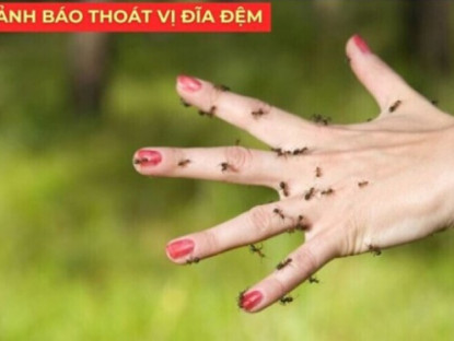 Thông tin doanh nghiệp - Tự kiểm tra nguy cơ thoát vị đĩa đệm nhờ 3 dấu hiệu xuất hiện ngay sau khi ngủ dậy
