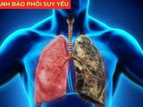 Đàm đặc mỗi sáng, ho mãi không dứt: Sai lầm nghiêm trọng khiến phổi ngày càng yếu