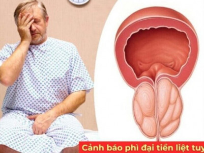 Thông tin doanh nghiệp - Có 1 trong 3 dấu hiệu này, quý ông nên kiểm tra tuyến tiền liệt càng sớm càng tốt!