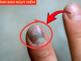 5 dấu hiệu báo động phổi đang 