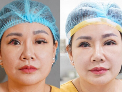 Thông tin doanh nghiệp - Bệnh viện Dr.Hải Lê: Deep Tech mùa 9 viết tiếp hy vọng cho nhiều ca mí lỗi hỏng