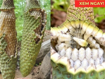 Thông tin doanh nghiệp - Mách nhỏ quý ông nào bị tiểu đêm nhiều lần, tiểu khó nên làm việc này ngay lập tức