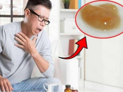 Thông tin doanh nghiệp - Đừng đợi đờm chuyển vàng xanh mới chú ý: 3 dấu hiệu này còn đáng lo hơn