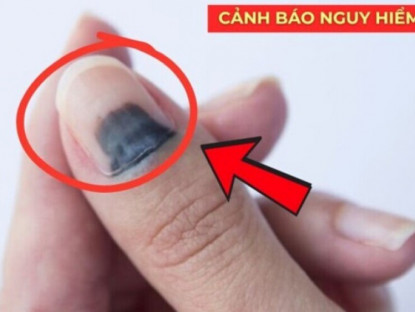 Thông tin doanh nghiệp - 5 dấu hiệu báo động phổi đang "xuống cấp" rất nhanh: Nhiều người hối hận vì biết quá muộn!