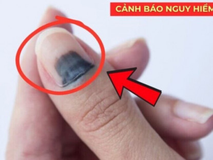 Thông tin doanh nghiệp - Loại rau dại mọc đầy đường nay được xem như “thuốc quý” cho đường tiết niệu, giúp đi tiểu thông thoáng, dễ dàng