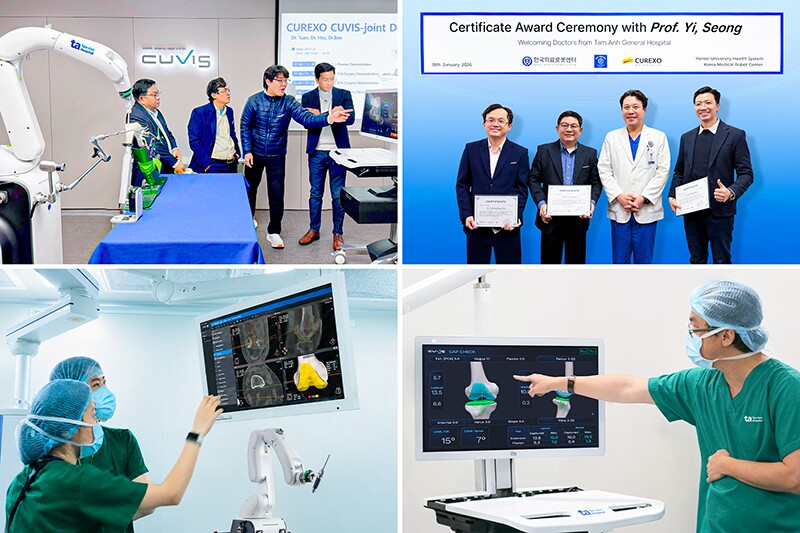 Top đầu thế giới, Tâm Anh vượt mốc 100 ca thay khớp phức tạp nhờ “siêu robot” AI - 5