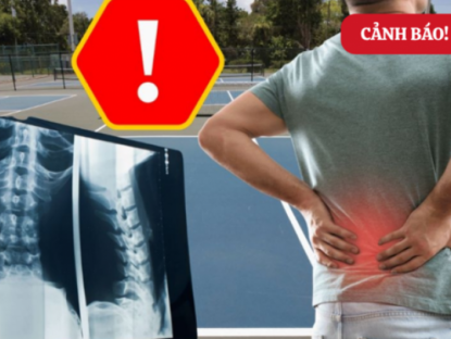 Thông tin doanh nghiệp - 4 môn thể thao người đau nhức xương khớp nên tránh, càng cố tập càng đau nặng hơn