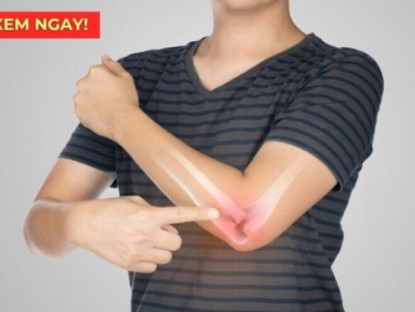 Thông tin doanh nghiệp - Dấu hiệu cảnh báo xương khớp đang bị tổn thương nghiêm trọng