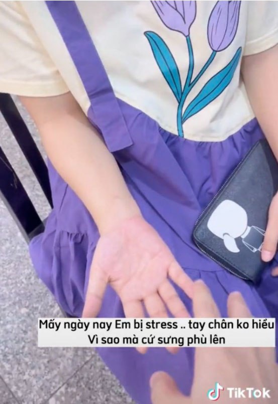 Múi Xù tăng gần 10kg khi mang thai nhưng em bé vẫn thiếu cân: Mẹ bầu ăn gì để vào con không vào mẹ? - 4