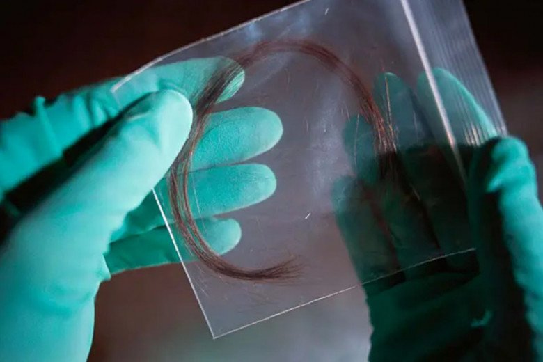 Vợ sinh 2 con, chồng lén lấy tóc xét nghiệm ADN vì nghi không phải con mình do không cùng nhóm máu - 2