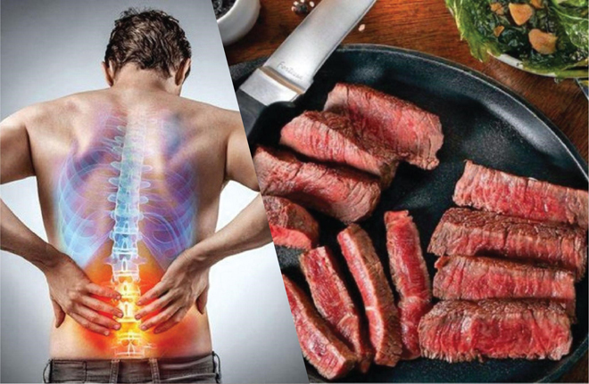 5 thực phẩm cần tránh xa nếu không muốn đau lưng tái phát liên tục! - 1
