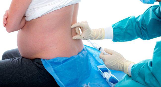 6 kiểu thai phụ dù muốn "đẻ không đau" nhưng vẫn bị bác sĩ sản khoa thẳng thừng từ chối - 1