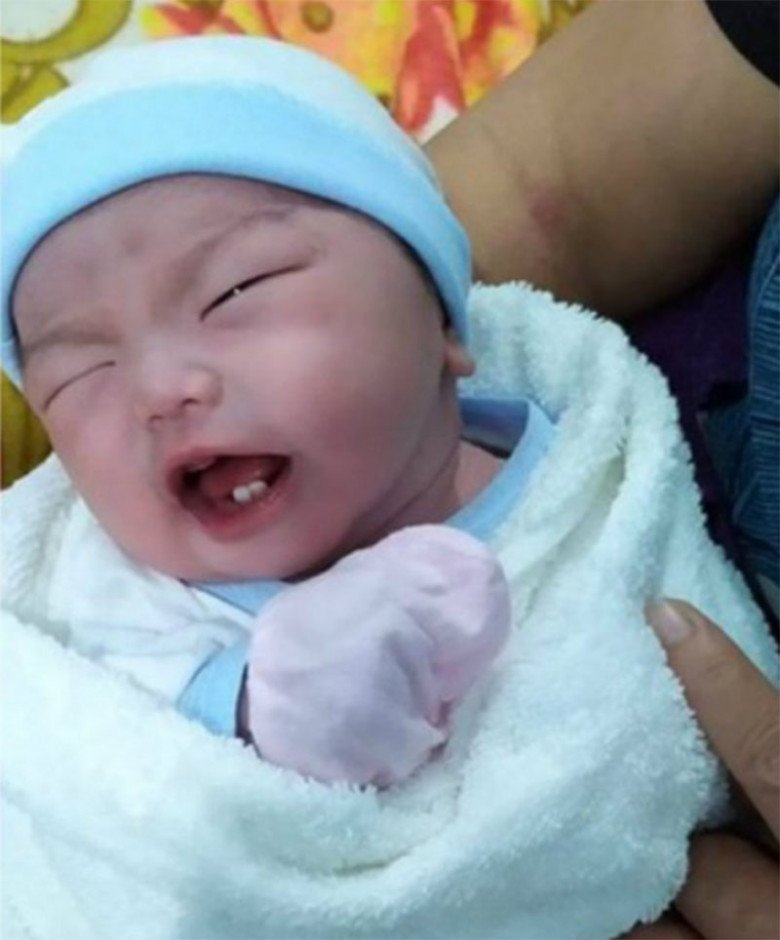 Thực hư việc con sinh ra đã có răng: Mẹ bầu lo đen đủi hay "trẻ ngậm ngọc” sẽ giàu sang phú quý cả đời? - 1