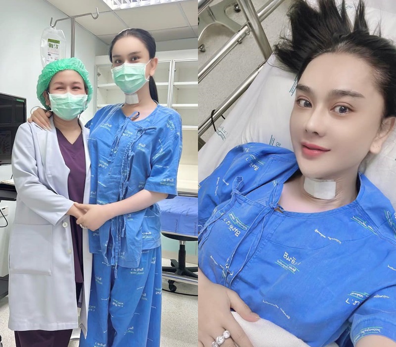 Lâm Khánh Chi sau khi tốn 5.000 USD chỉnh giọng: Nói không được, phải ghi ra giấy - 1