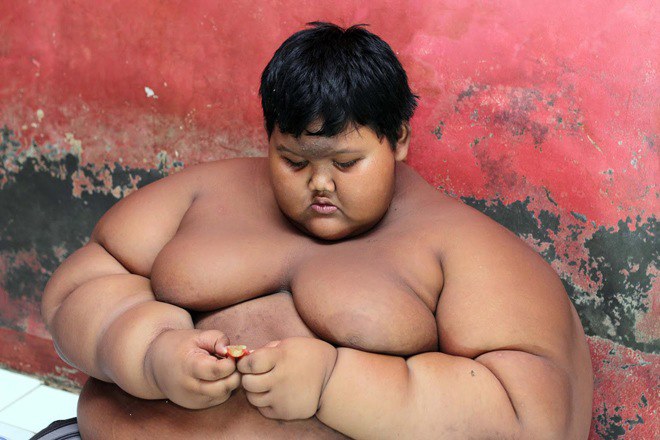 Hình ảnh gầy thon hiện tại của bé trai 10 tuổi 200kg vì thức ăn nhanh từng khiến thế giới bàng hoàng - 2