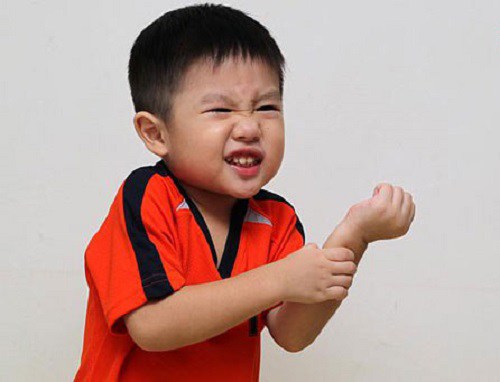 Bé 6 tuổi Hà Nội sốt trên 40 độ, sốc nhiễm khuẩn vì hành động ai cũng làm sau khi bị muỗi đốt - 1