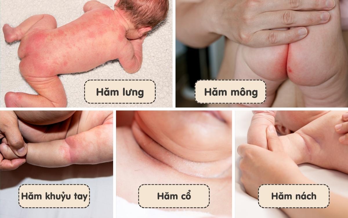 Đánh bay hăm da ở trẻ sơ sinh nhờ bí quyết tắm đặc biệt - 1