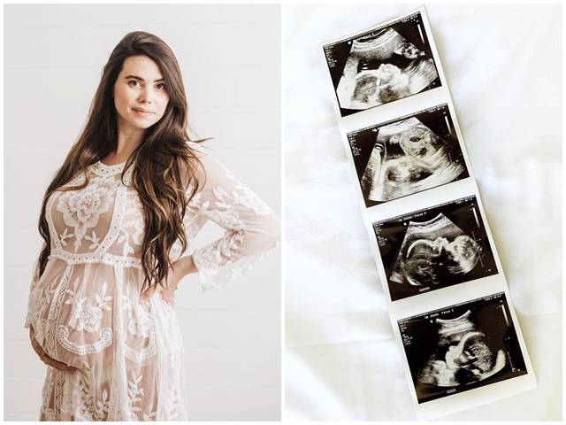 Bà mẹ 5 con đi siêu âm thai, kết quả nhận về khiến người chồng "đứng hình" - 2