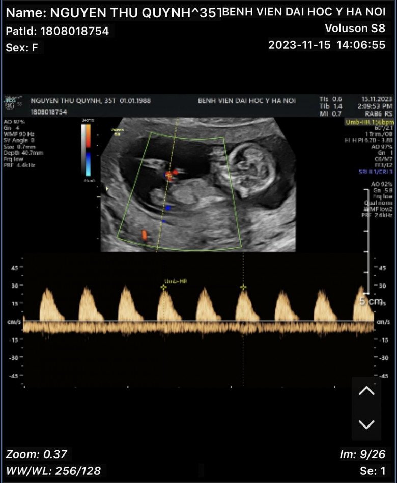 Diễn viên Thu Quỳnh bất ngờ thông báo mang thai lần 2 - 2